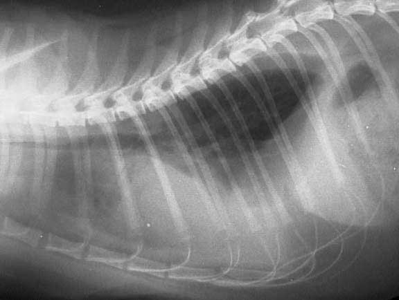 Xray After Draining Fluid