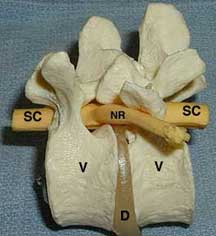 Plastic model of the vertebrae and spinal cord