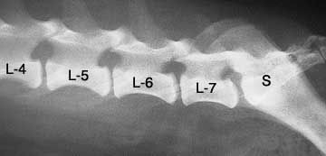X-Ray of the lumbar vertebrae and sacrum