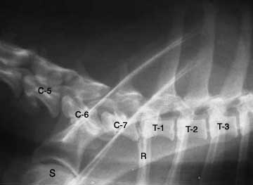 X-Ray of the cervical and thoracic vertebrae