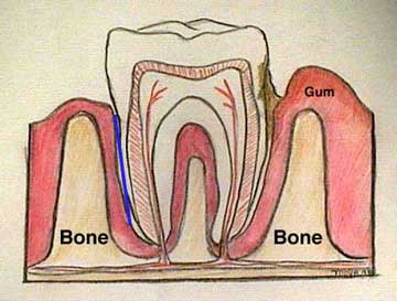 Diagram of a Normal Tooth