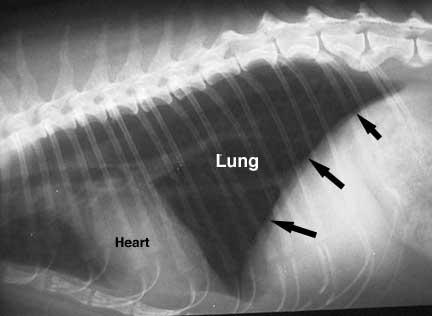 X-ray of chest with arrows pointing to the diaphragm
