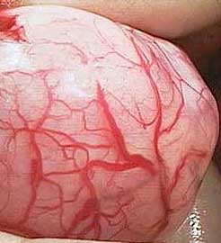 Blood vessels surrounding capsule of a kidney