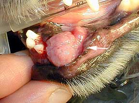 Malignant Tumor In A Mouth
