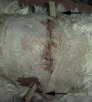 Penrose drain in sutured wound