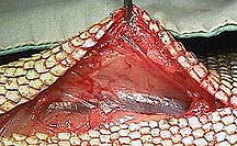 Incision in scales showing large vein just under the scales