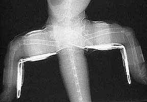 X-ray of the rear legs and splints