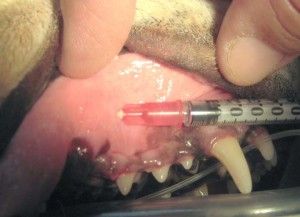 Injecting Local Anesthetic