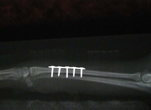 X-ray of bone plate on a dog forearm