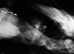 X-ray of a pelican with a fish hook and fishing line it is body