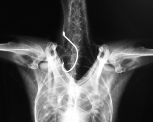 X-ray of a large hook stuck in the crop of a cormorant