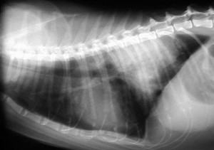Xray Of Lung With Fluid Buildup