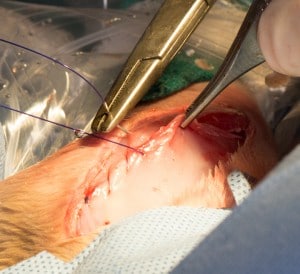 Suturing the muscle layer