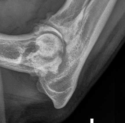Xray of an Arthritic Elbow