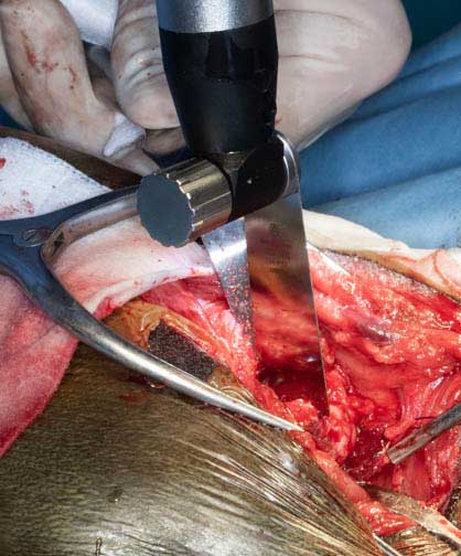 Oscillating saw cutting the neck of the femur