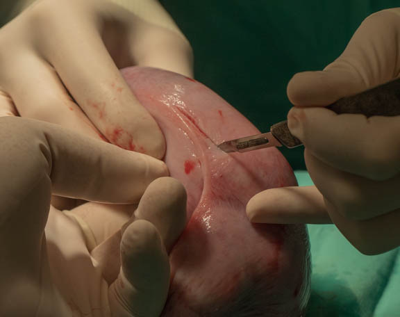 Cutting into uterus