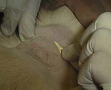 Nurse wearing gloves applying pain patch