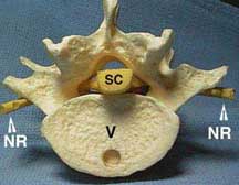 Model over vertebrae and spinal cord