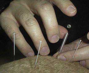 Acupuncture needles in a dog's back