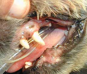 Surgical Area After Tumor Is Removed