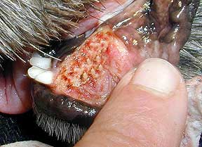 Surgical Site After Tumor Removal