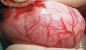 Blood supply on outside of kidney