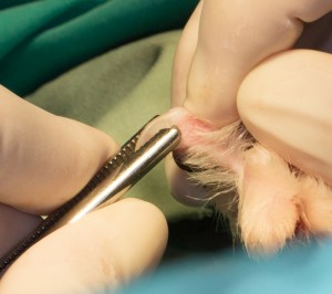 Retracting Nail With Laser