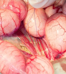 IggieOVH-folliclesligation Close up of the blood supply to the eggs