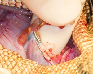 IggieOVH-hemoclip2 Three hemoclips on the blood supply to the ovary