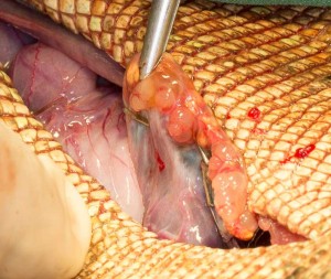 IggieOVH-hemoclip3 Ovary and hemoclips from a different angle