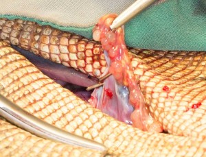 IggieOVH-hemoclip4 Adding hemoclips along the blood supply to the ovary