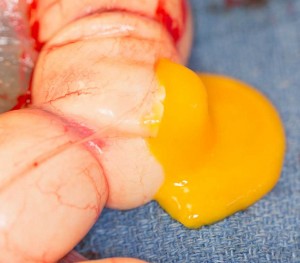 Yolk coming out of one of the eggs