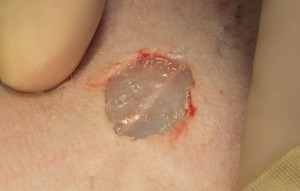 Muscle layer under abdomen