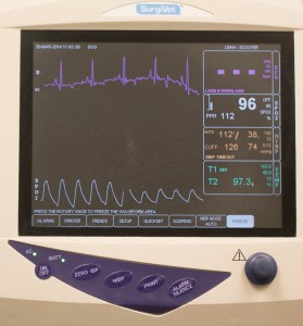 Picture of anesthetic monitor showing heart and respiratory rates