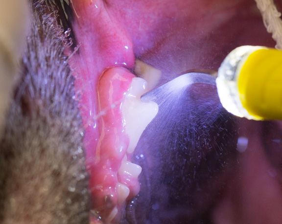 Dentistry-teeth-scaling-29