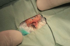 The surgical site showing no bleeding after surgery