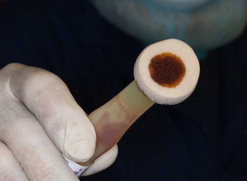 Sponge used to apply final scrub