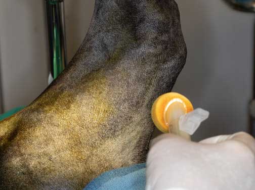 Sponging the DuraPrep on the leg