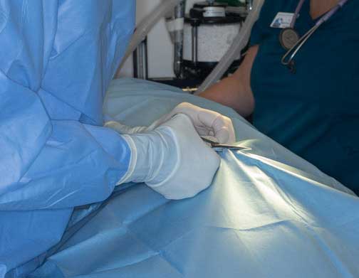 Cutting a hole in the drape to expose the leg