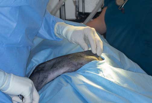 Palpating landmarks before final draping