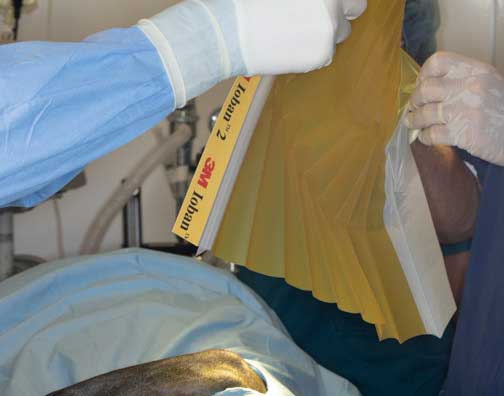 Opening up the aseptic barrier