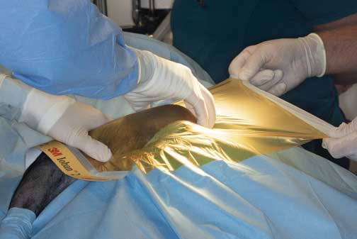 Molding the aseptic barrier to the leg