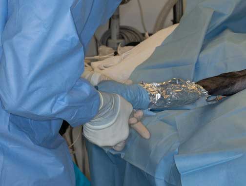 Sterile tape over the aluminum foil