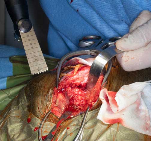 Exposing the femoral head through the incision