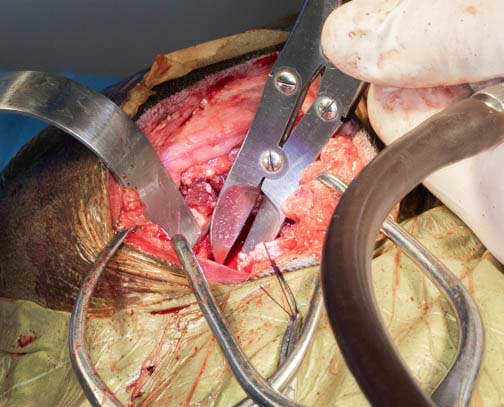 Smoothing off the cut edge of bone with a rongeur