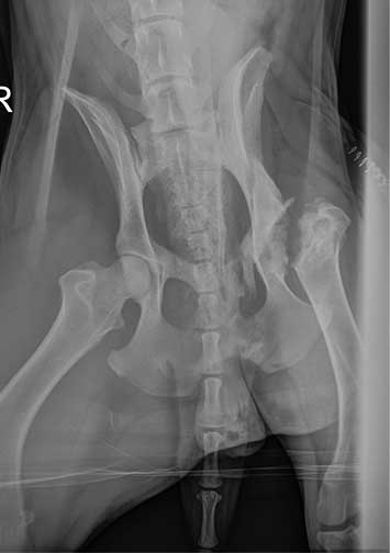 Post op Xray with head of femur removed