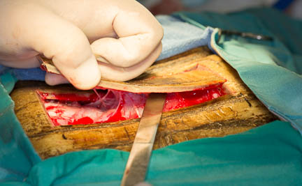 Tortoise-bladder-stone-surgery-prying-shell.jpg