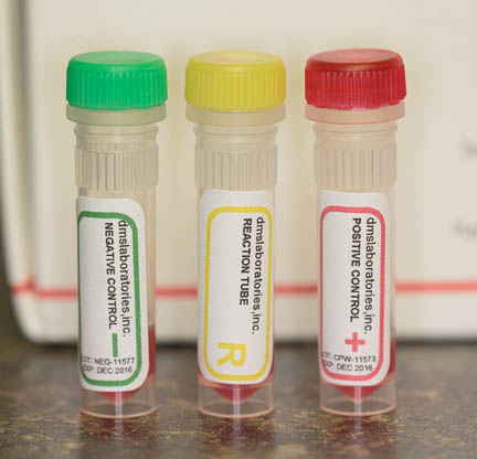 Blood Typing Tubes used to perform a crossmatch