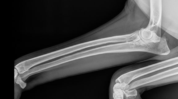 Xray of normal dog forearm